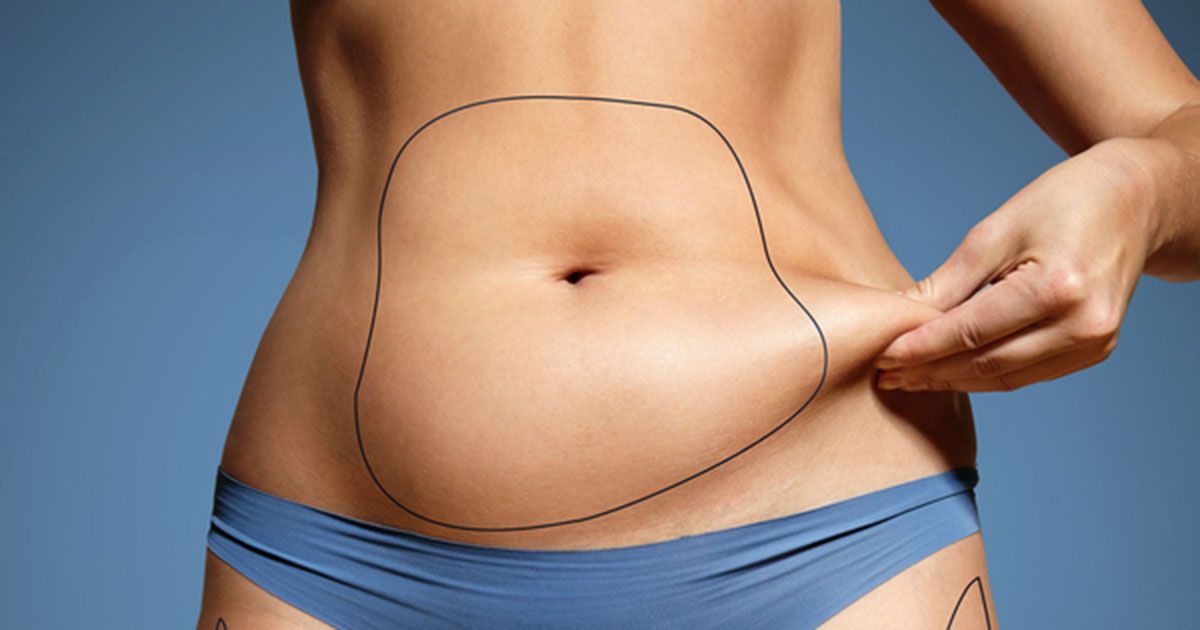 Belly Fat Freezing with CoolSculpting, CoolSculpting Stomach