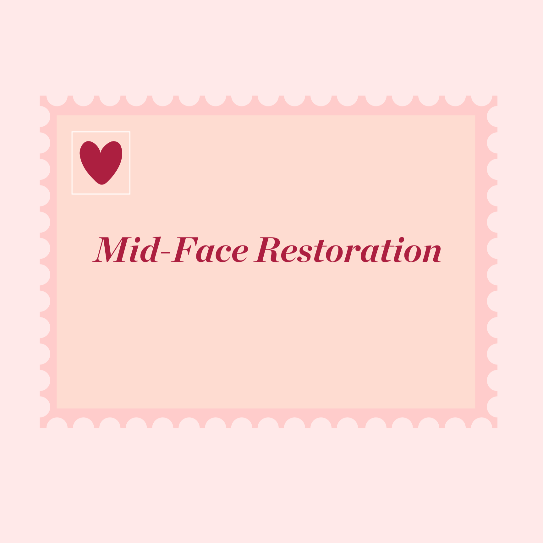 Mid Face Restoration